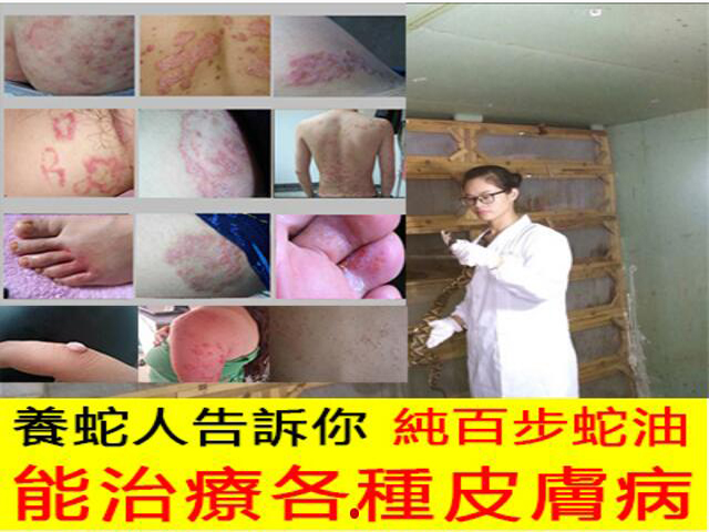 蛇油